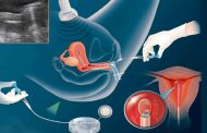 Benefits of using the IUI treatment