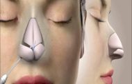 The Science Behind Rhinoplasty: What to Expect